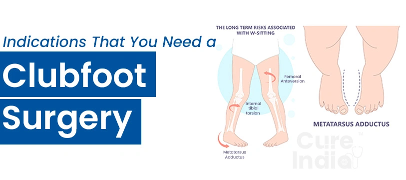 Indications for a Clubfoot Surgery